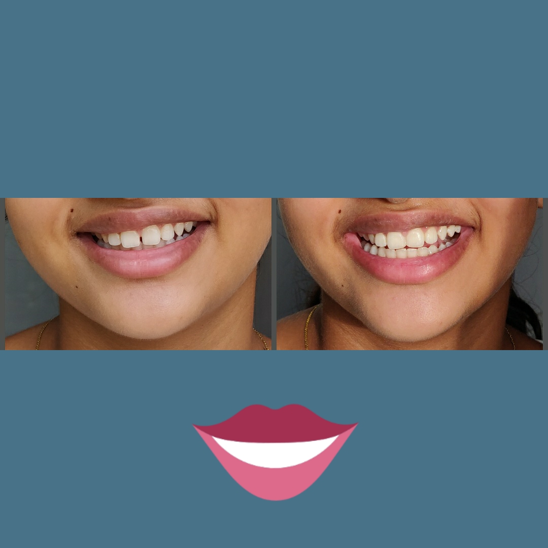 Dr. Archana's Silver Dental Care - Modern Clinic Interior Photo 3 in Navapur, Rayangan