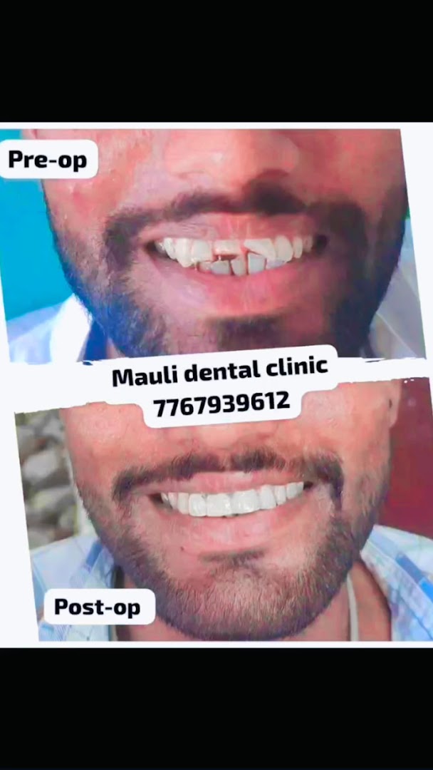 Dr. Kayande Mauli Dental Clinic And Implant Centre - Modern Clinic Interior Photo 4 in Sindkhed Raja
