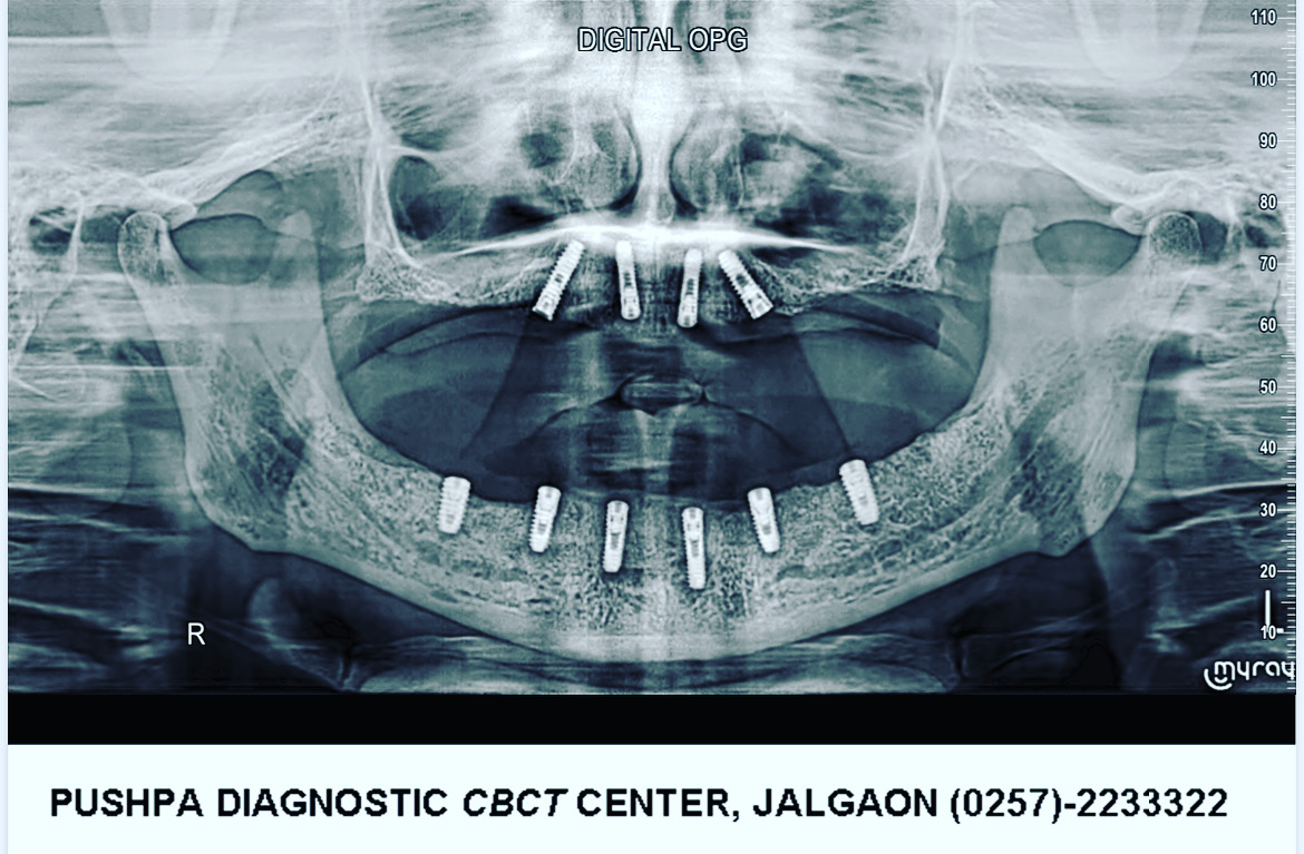 Dr.Pritam Chaudhari's Exclusive Oral &Maxillofacial Surgery Clinic - Modern Clinic Interior Photo 4 in Jalgaon