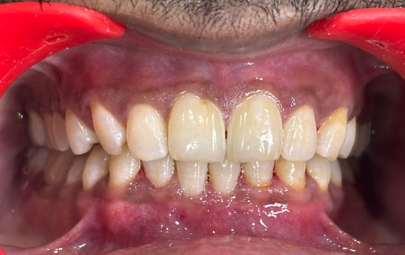 Excellence Dental Solutions - Modern Clinic Interior Photo 2 in Chhatrapati Sambhajinagar