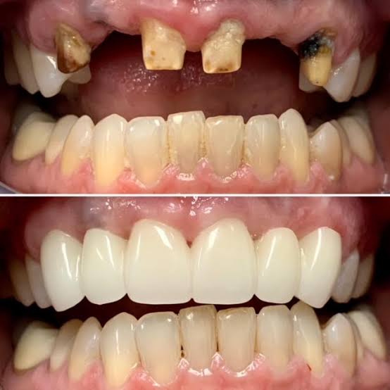 Moraya Multi-Speciality Dental & Implant Center - Dr. Tushar Patil, Top Dentist in Savda, Raver,Faizpur - Modern Clinic Interior Photo 2 in Savda