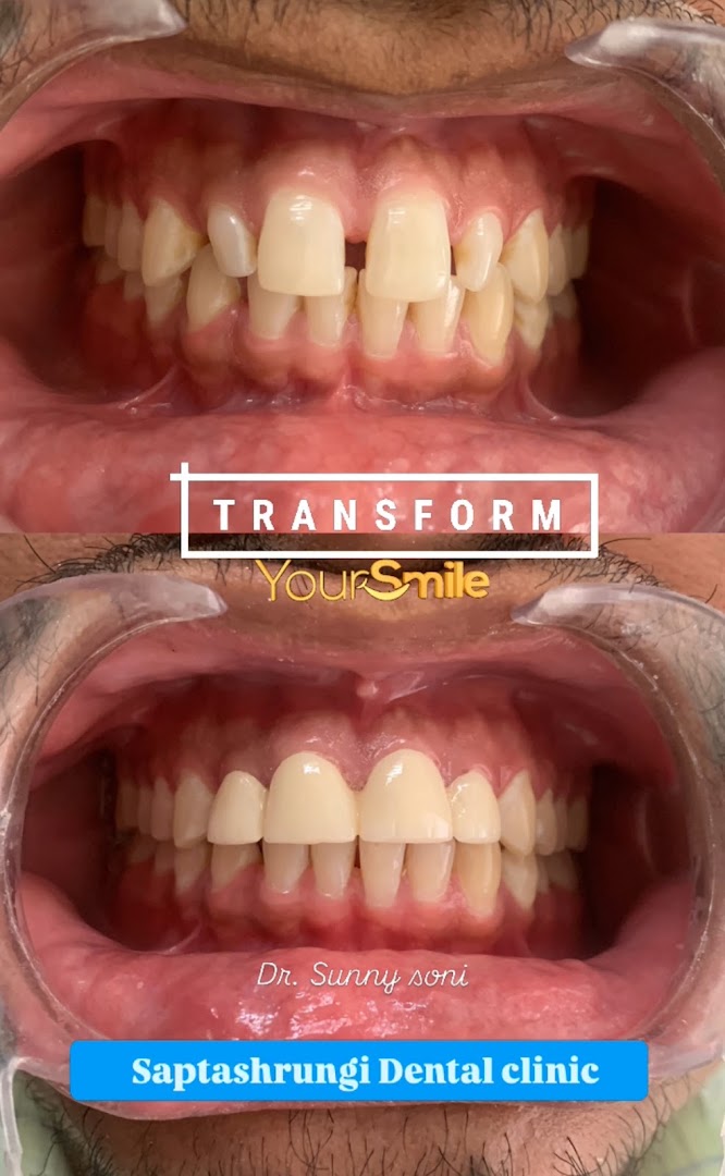 Saptashrungi Dental Clinic Sendhwa || Best Dental Clinic | Dentist | Dental Surgeon | Root Canal Specialist - Modern Clinic Interior Photo 4 in Sendhwa