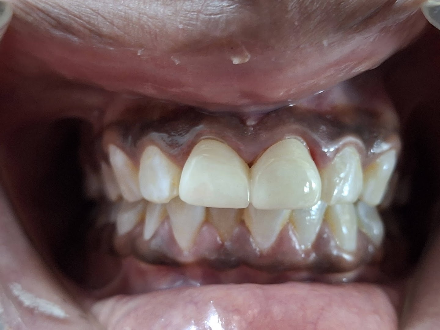 Speciality Ortho Dental Implant Clinic - Modern Clinic Interior Photo 1 in Jalgaon