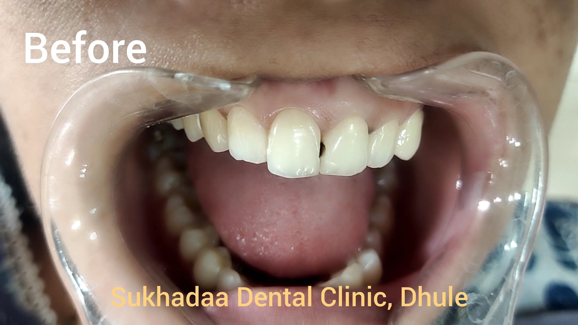 Sukhadaa Dental Clinic (Sukhada) Dhule ! Dr. Vinay Sonawane & Dr. Jagruti Sonawane - Modern Clinic Interior Photo 4 in Dhule