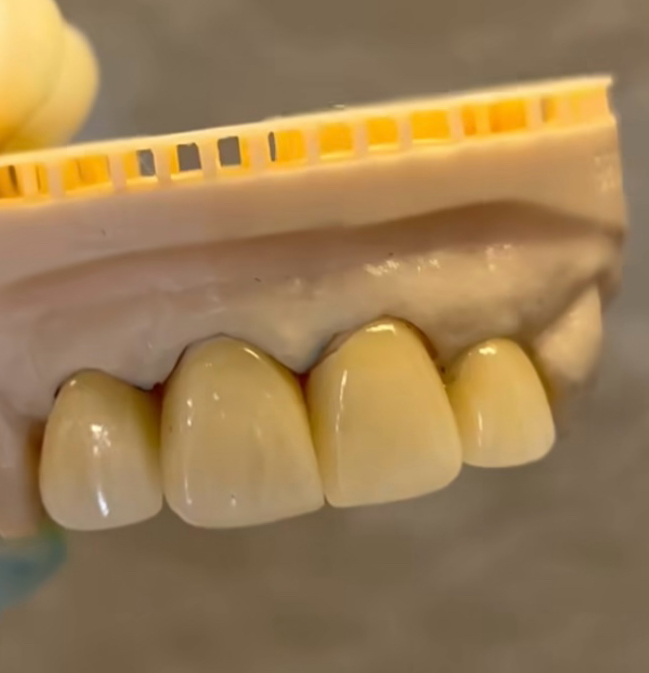 Avani dental clinic kalwan