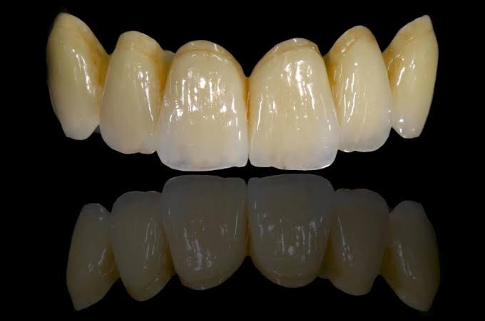 Dental Clinic (daataaNcaa dvaakhaanaa )