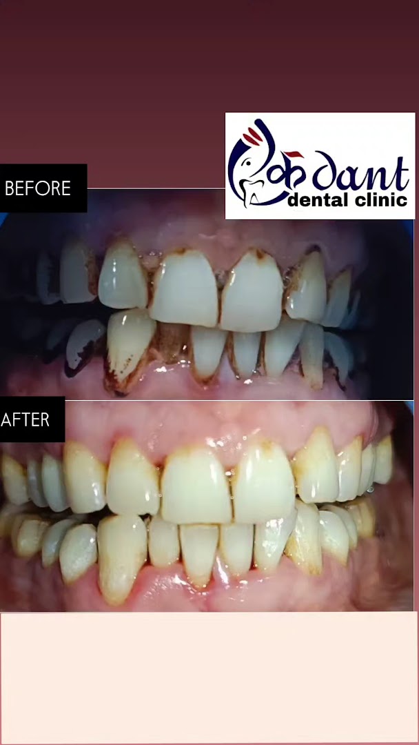 Ekadanta dental clinic (ekdNt daataaNcaa dvaakhaanaa)