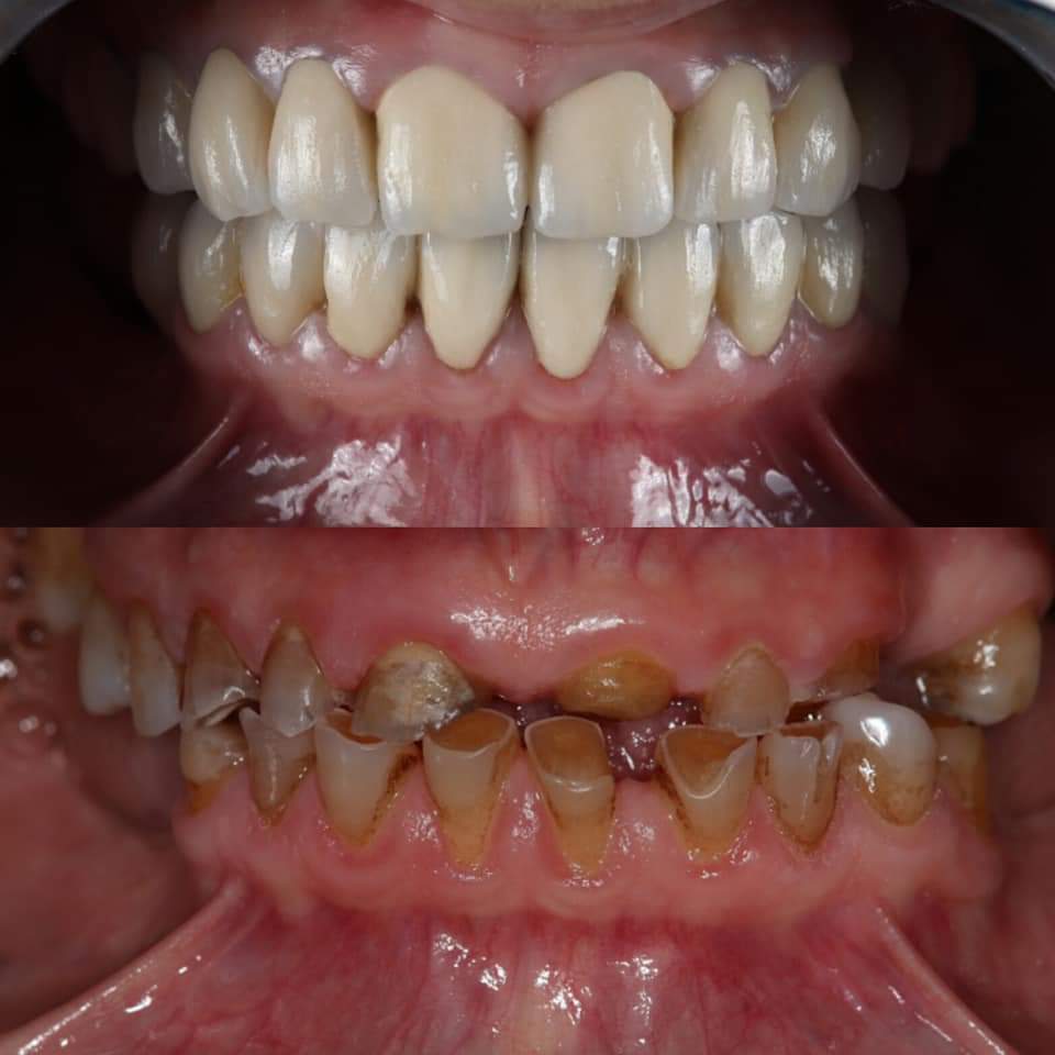 EXPERT DENTAL CLINIC AND IMPLANT CENTRE