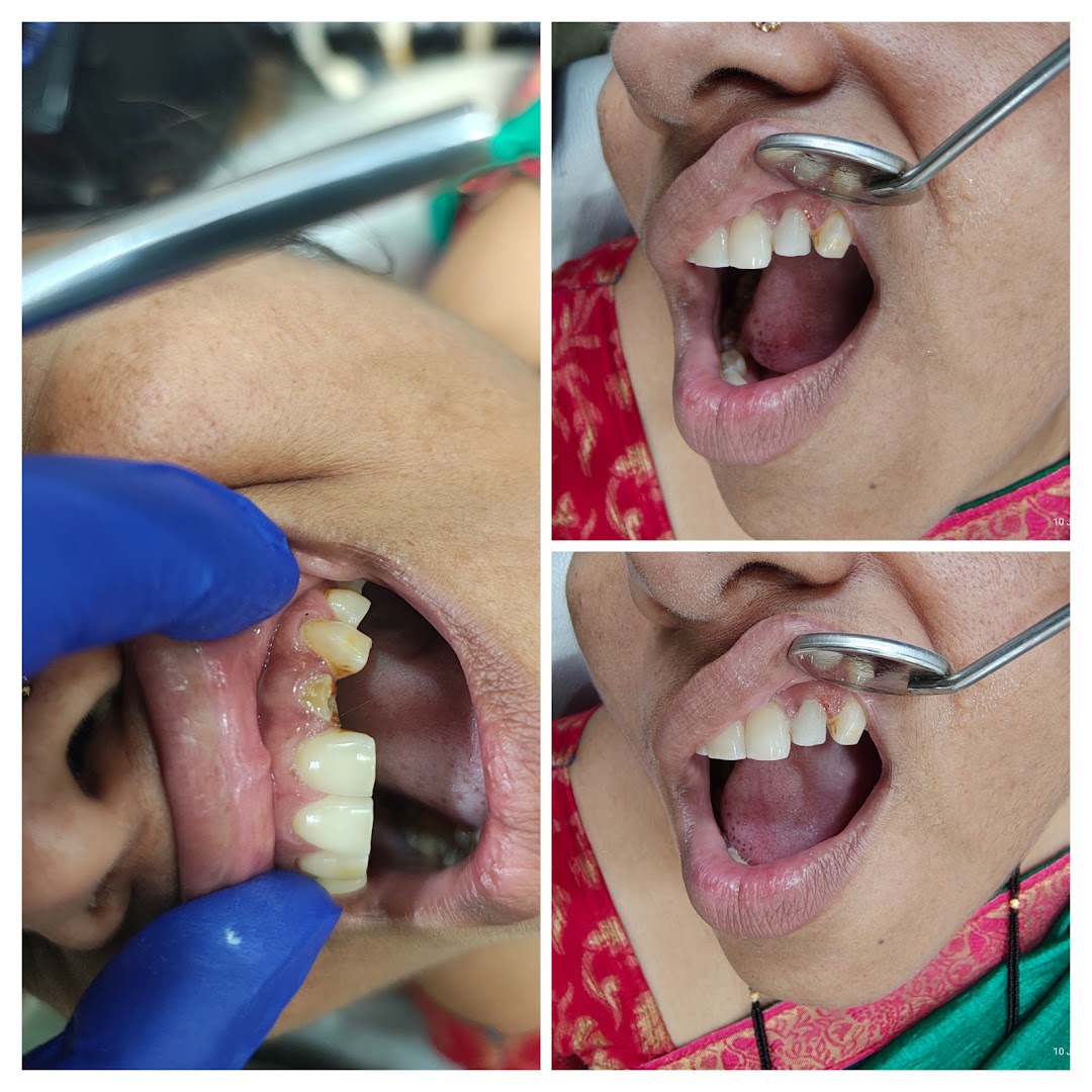 Janhavi Multi Specility Dental Clinic OPG clinic