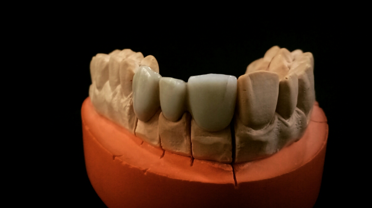Rane's Pride 32 Dental Craft