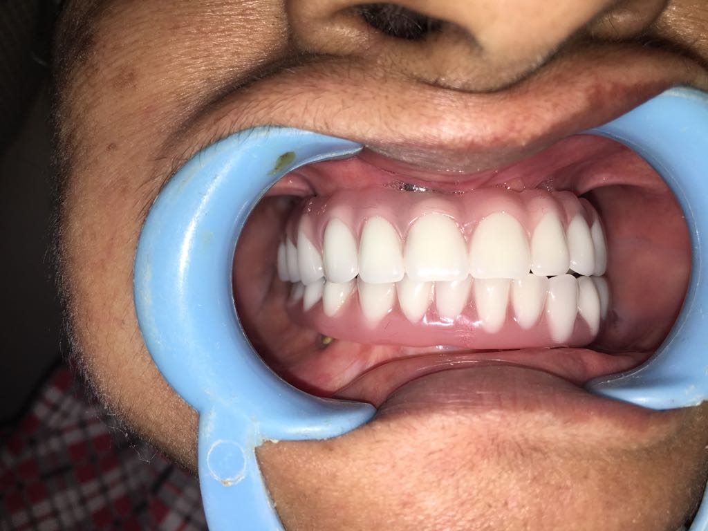 Shruti Dental multispectiality and implant clinic