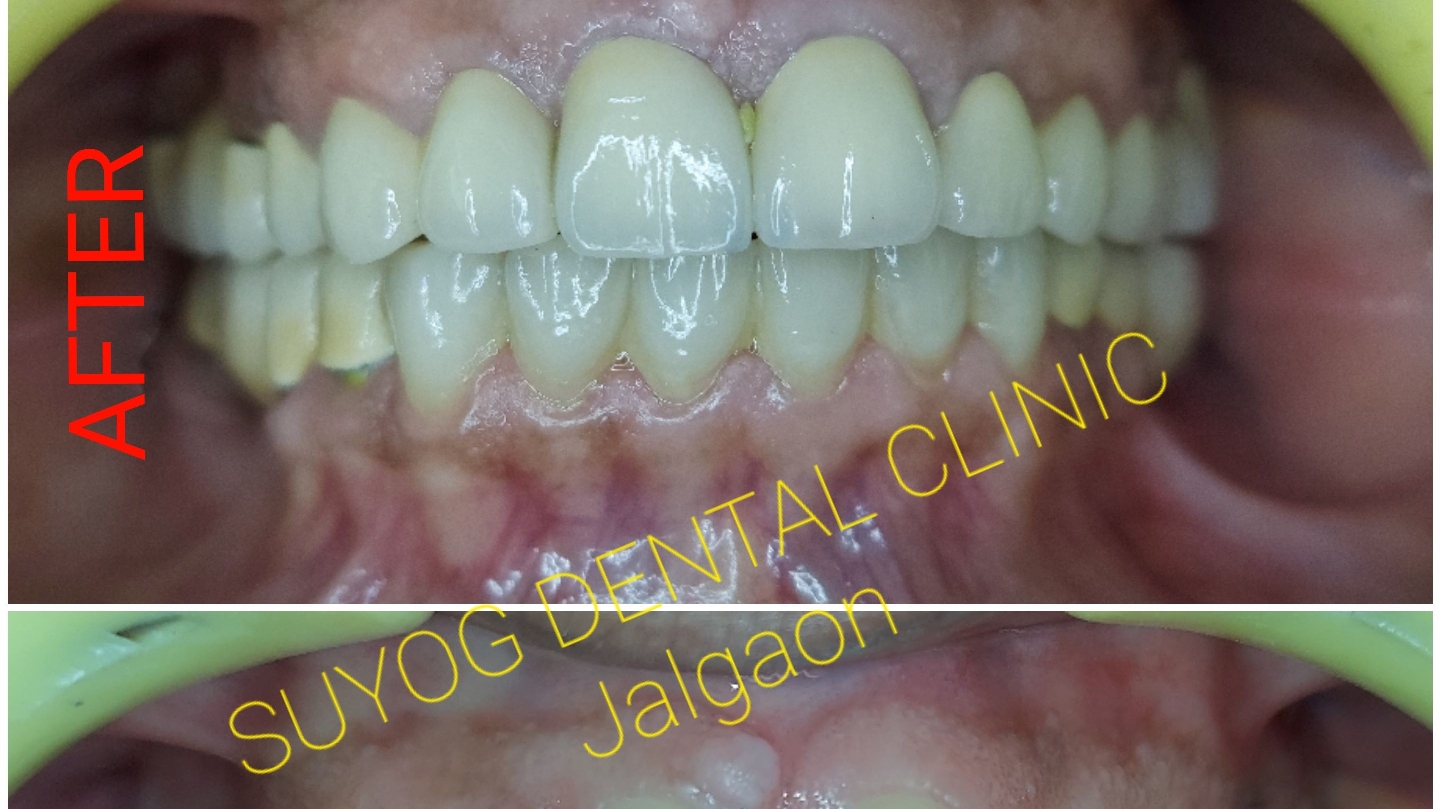 SUYOG DENTAL CLINIC AND IMPLANT CENTRE